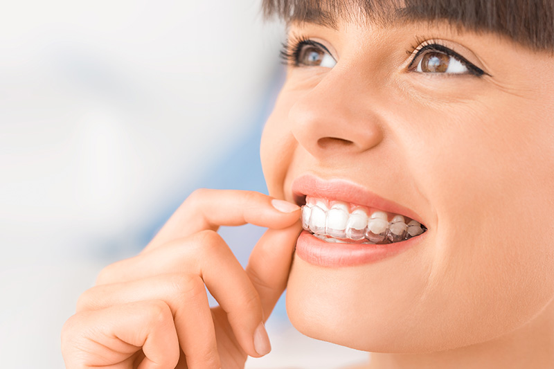 Invisalign in Greer